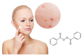 cách dùng Benzoyl Peroxide